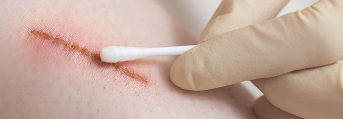 Medical assistant changes the dressing of a wound at the emergency room